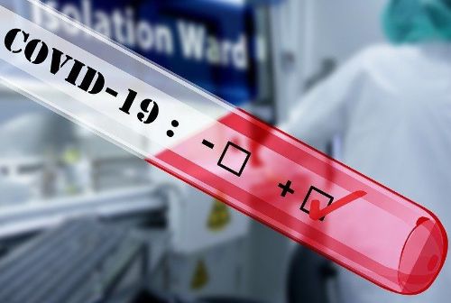 В Кольцово продолжается борьба с COVID-19
