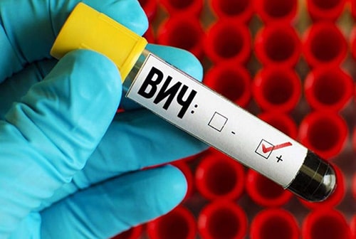 Жителей НСО приглашают пройти бесплатный экспресс-тест на ВИЧ