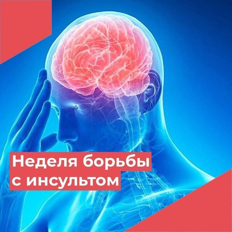 Неделя борьбы с инсультом началась в стране